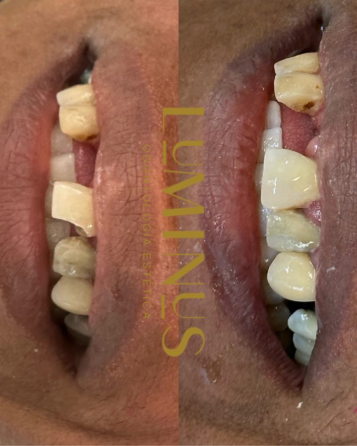 Luminus Odontologia Estética em Salvador