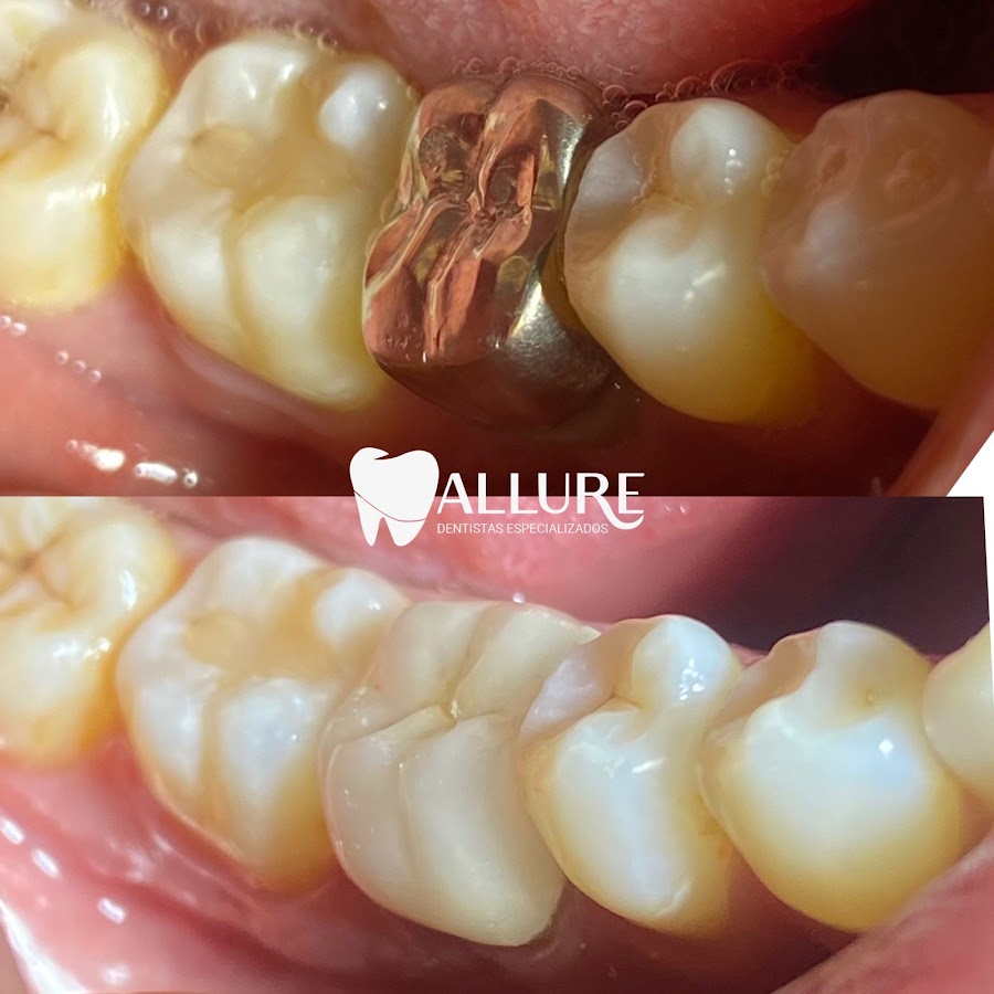 Allure Dentistas Especializados em Belo Horizonte